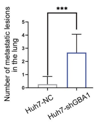 The effect of GBA1 loss-of-function on spontaneous lung metastasis.jpg